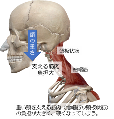 スマホの普及でますます増加中 肩こりからくる頭痛 新長田カイロプラクティック ふたば整体院
